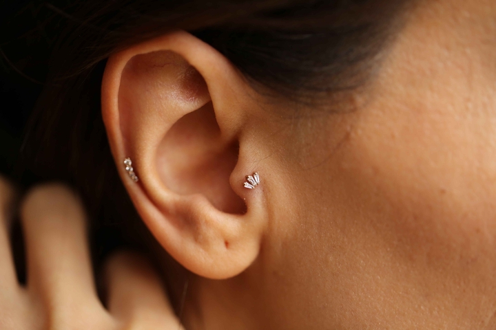 Trapez Üçlü Tragus - REİS